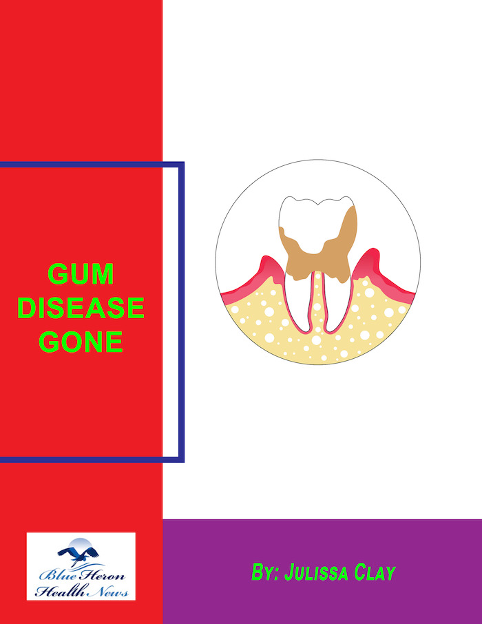 Gum Disease Gone